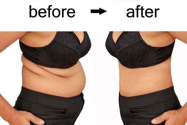 Weight Loss